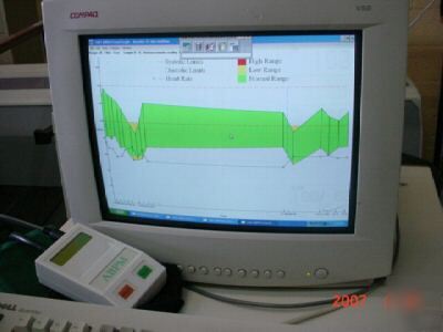 New ambulatory blood pressure monitoring system ( ). 