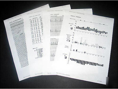 Canine proscan K9 holter monitor/analyzer + printer